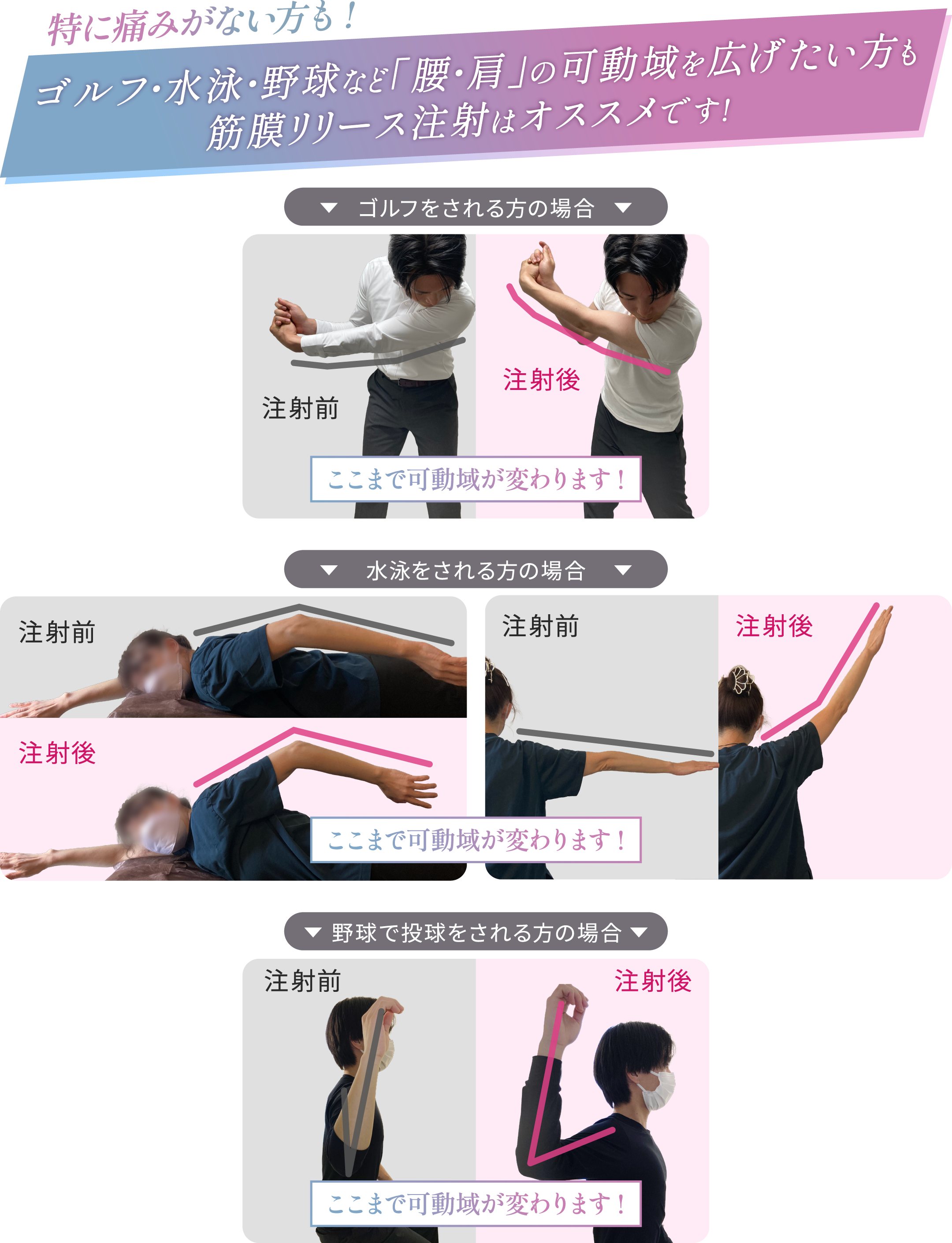 注射直後、見た目がこんなにも変わります！